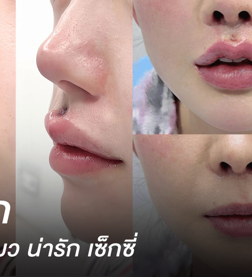 ทำปากแมว ศัลยกรรมที่จีน